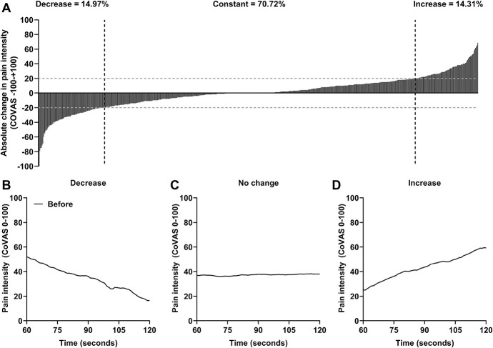 Clusters of facilitatory and inhibitory conditioned pain modulation responses in a large sample of children, adolescents, and young adults with chronic pain.