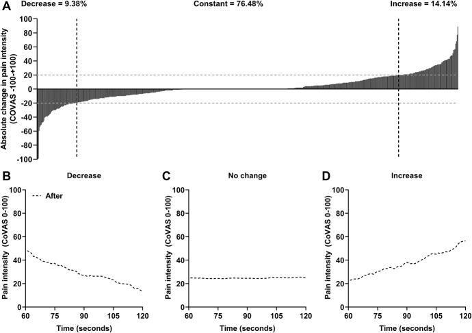 Clusters of facilitatory and inhibitory conditioned pain modulation responses in a large sample of children, adolescents, and young adults with chronic pain.