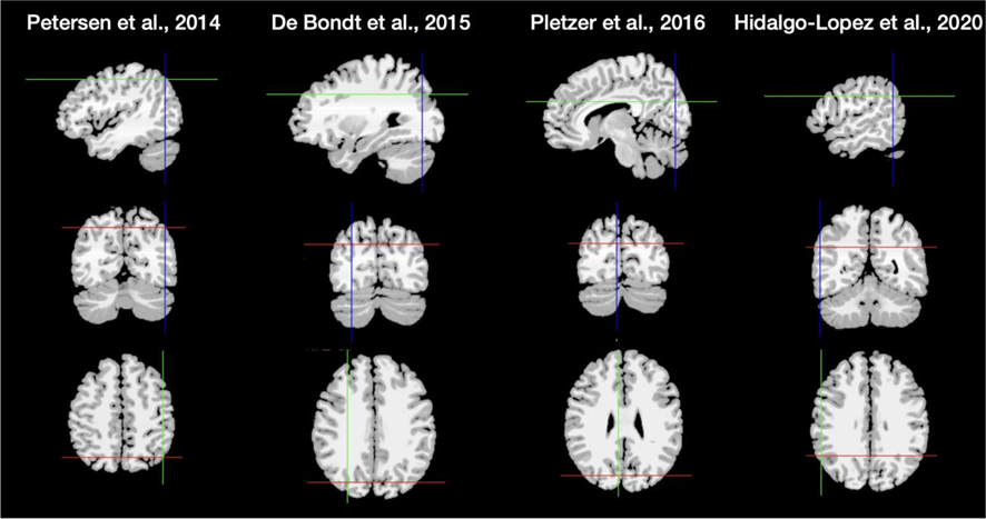 Hormone-based models for comparing menstrual cycle and hormonal contraceptive effects on human resting-state functional connectivity