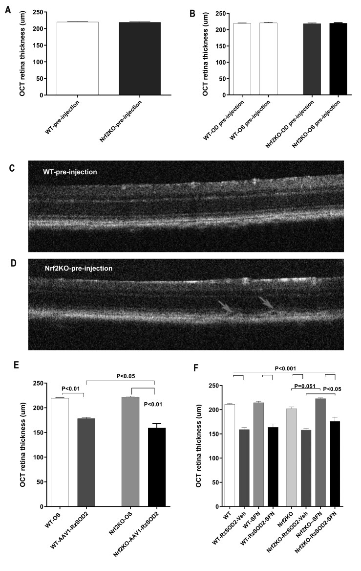 Sulforaphane recovers cone function in an Nrf2-dependent manner in middle-aged mice undergoing RPE oxidative stress.