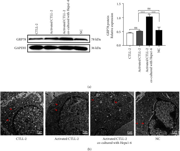 Depletion and Reversal of Hepatocellular Carcinoma Inducing CTL through ER Stress-Dependent PERK-CHOP Signaling Pathway.