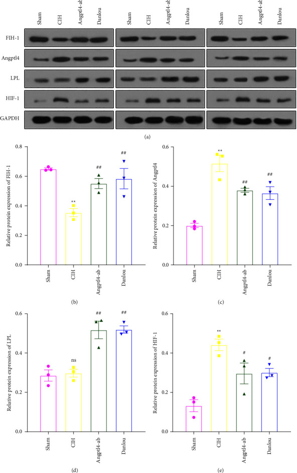 Danlou Tablet May Alleviate Vascular Injury Caused by Chronic Intermittent Hypoxia through Regulating FIH-1, HIF-1, and Angptl4.