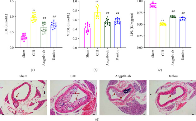 Danlou Tablet May Alleviate Vascular Injury Caused by Chronic Intermittent Hypoxia through Regulating FIH-1, HIF-1, and Angptl4.