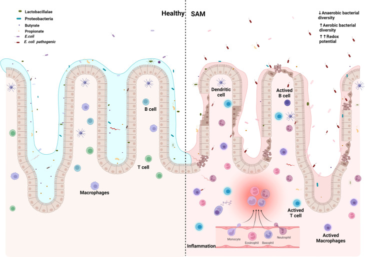 The synergistic interaction of systemic inflammation, dysbiosis and antimicrobial resistance promotes growth restriction in children with acute severe malnutrition: An emphasis on <i>Escherichia coli</i>.