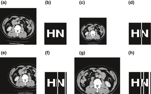 Robust watermarking algorithm for medical images based on accelerated-KAZE discrete cosine transform