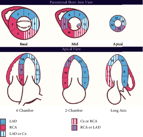 The Prognostic Value of Echocardiographic Wall Motion Score Index in ST-Segment Elevation Myocardial Infarction.