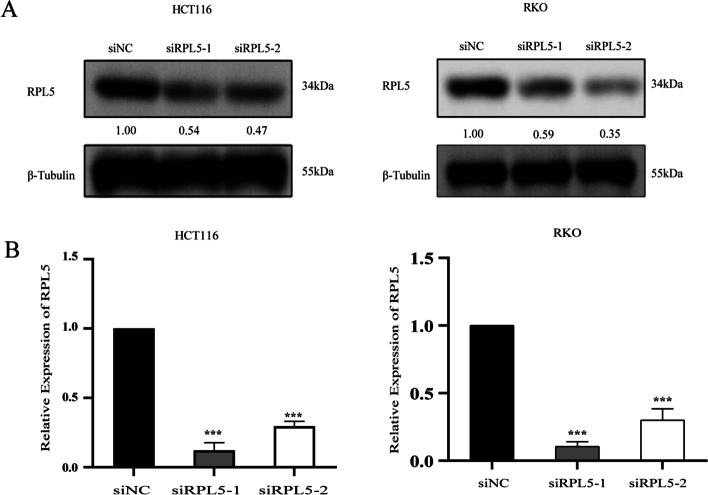 Ribosomal protein RPL5 regulates colon cancer cell proliferation and migration through MAPK/ERK signaling pathway.