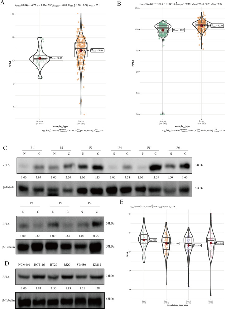 Ribosomal protein RPL5 regulates colon cancer cell proliferation and migration through MAPK/ERK signaling pathway.