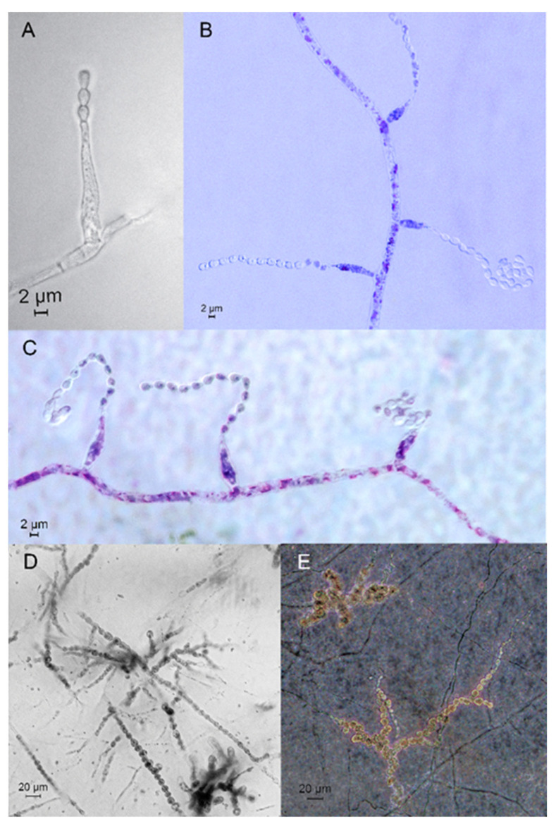 <i>Trichocladium solani</i> sp. nov.-A New Pathogen on Potato Tubers Causing Yellow Rot.