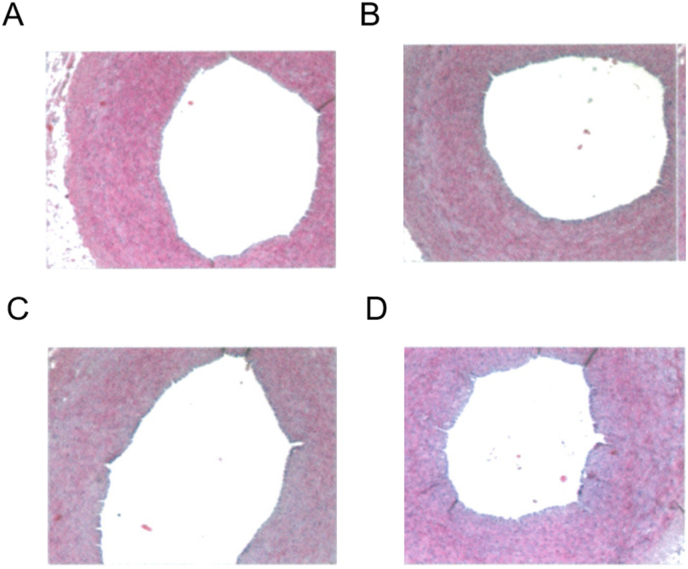 Evaluation of using a double helical, closed-cell stent-retriever (Skyflow) for thrombectomy procedures in acute arterial occlusion: A preclinical study and a clinical trial