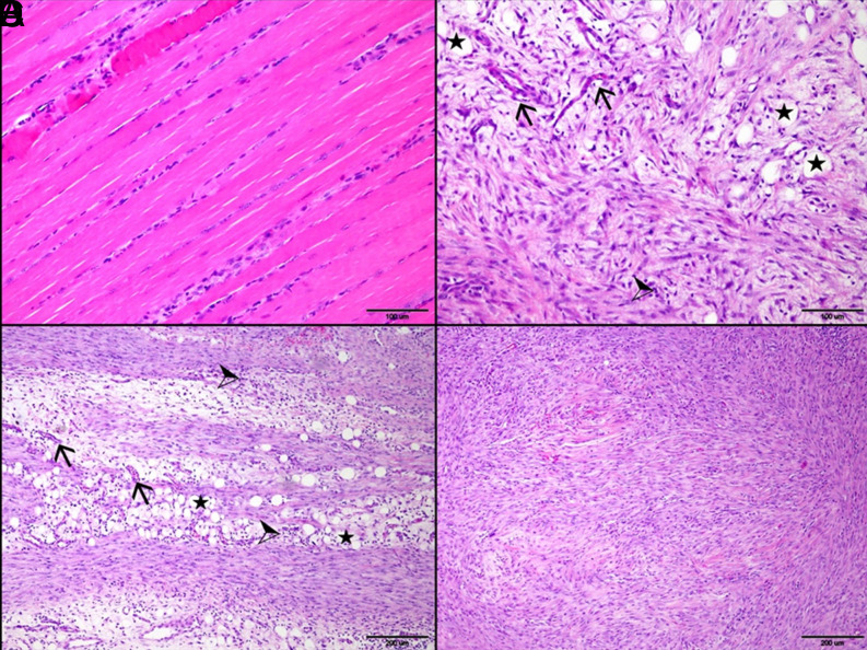 Investigation into the effect of systemic single high-dose erythropoietin on the healing of Achilles tendons in rats.