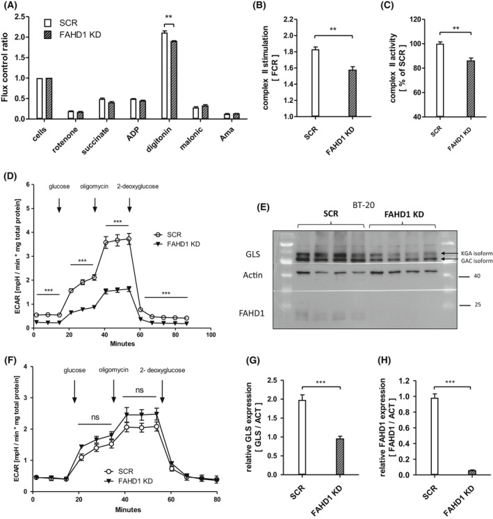 The mitochondrial enzyme FAHD1 regulates complex II activity in breast cancer cells and is indispensable for basal BT-20 cells in vitro.