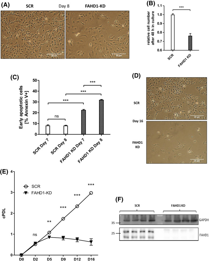 The mitochondrial enzyme FAHD1 regulates complex II activity in breast cancer cells and is indispensable for basal BT-20 cells in vitro.