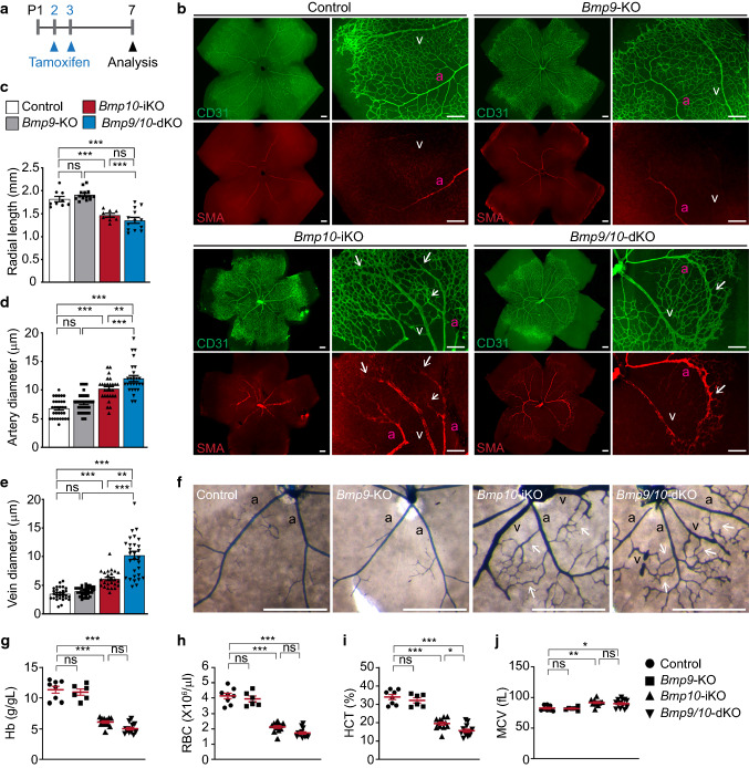 BMP10 functions independently from BMP9 for the development of a proper arteriovenous network