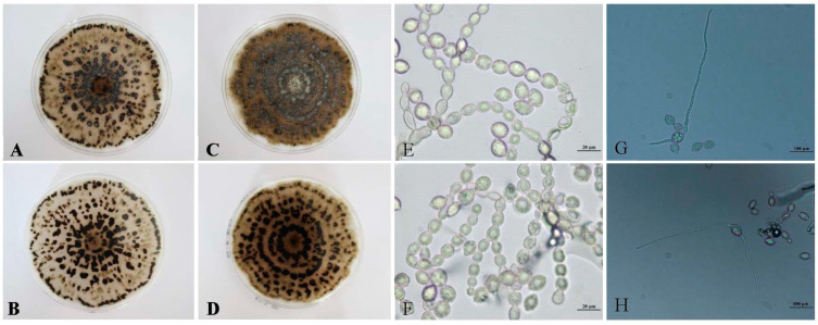 Morphological and Molecular Identification of Peach Brown Rot Disease in Tibet and Exploration of the Biocontrol Efficiency of <i>Trichoderma</i>.