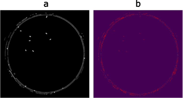 Machine learning for enumeration of cell colony forming units.