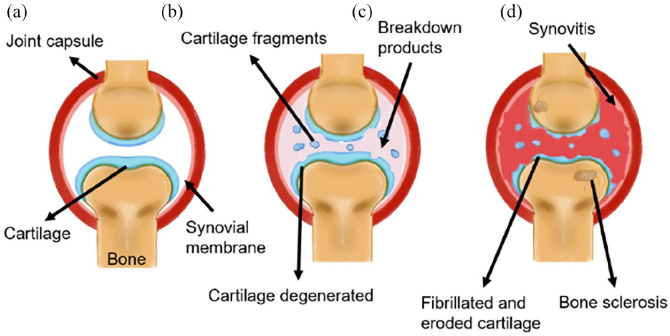 Biofabrication of the osteochondral unit and its applications: Current and future directions for 3D bioprinting.