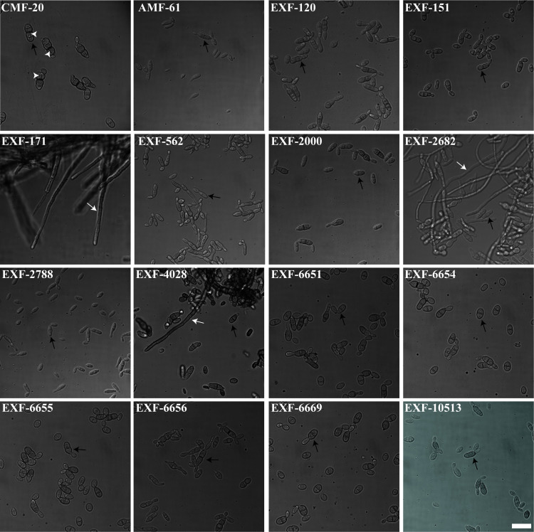 <i>Hortaea werneckii</i> isolates exhibit different pathogenic potential in the invertebrate infection model <i>Galleria mellonella</i>.