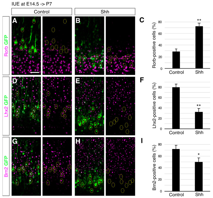 Activation of Sonic Hedgehog Signaling Promotes Differentiation of Cortical Layer 4 Neurons via Regulation of Their Cell Positioning.