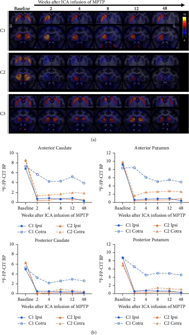 Determination of the Unilaterally Damaged Region May Depend on the Asymmetry of Carotid Blood Flow Velocity in Hemiparkinsonian Monkey: A Pilot Study.
