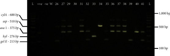 Determination of <i>Enterococcus faecalis</i> and <i>Enterococcus faecium</i> Antimicrobial Resistance and Virulence Factors and Their Association with Clinical and Demographic Factors in Kenya.