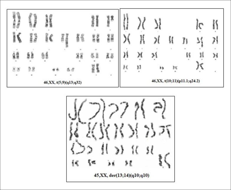 The pattern of chromosomal abnormalities in recurrent miscarriages: a single center retrospective study.