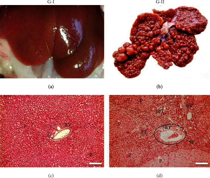 Model of Liver Fibrosis Induction by Thioacetamide in Rats for Regenerative Therapy Studies.