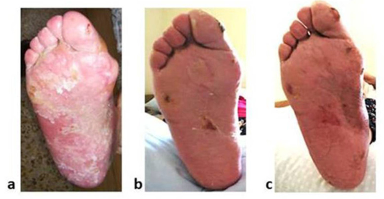 Concomitant Administration of Capecitabine and Folate Supplements: Need to Encourage Medication Reconciliation.