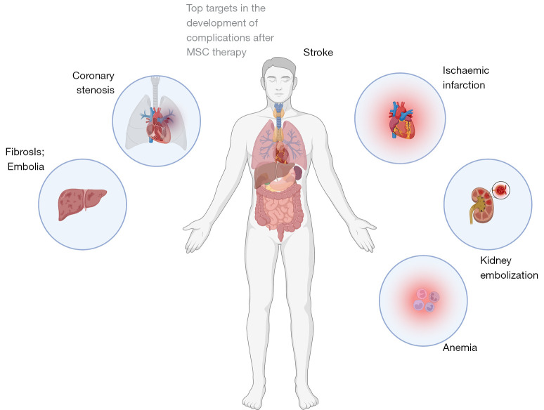 Adverse events, side effects and complications in mesenchymal stromal cell-based therapies.