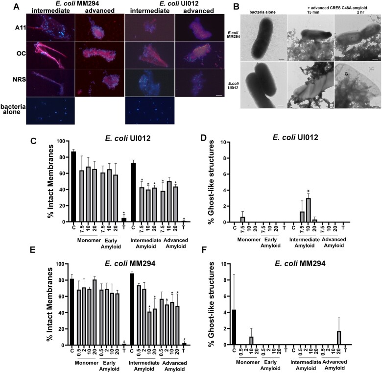 Host defense functions of the epididymal amyloid matrix.