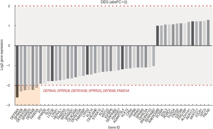 The Expression of Defensin-Associated Genes May Be Correlated With Lymph Node Metastasis of Early-Stage Tongue Cancer.