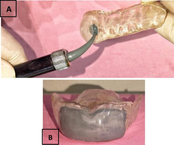 Protective and positioning devices in maxillofacial prosthodontics and radiotherapy: Overview