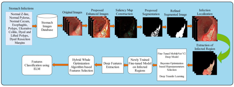 GestroNet: A Framework of Saliency Estimation and Optimal Deep Learning Features Based Gastrointestinal Diseases Detection and Classification.