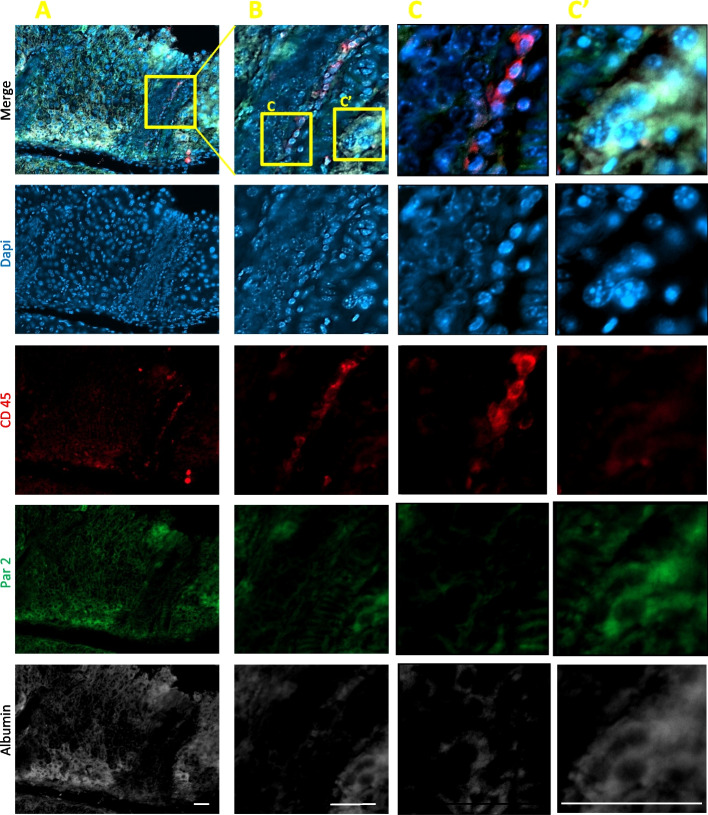 Resolving the conflicts around Par2 opposing roles in regeneration by comparing immune-mediated and toxic-induced injuries.