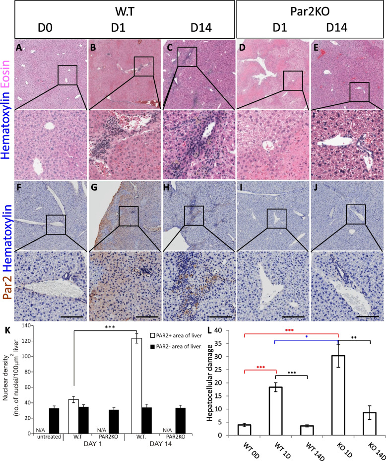 Resolving the conflicts around Par2 opposing roles in regeneration by comparing immune-mediated and toxic-induced injuries.