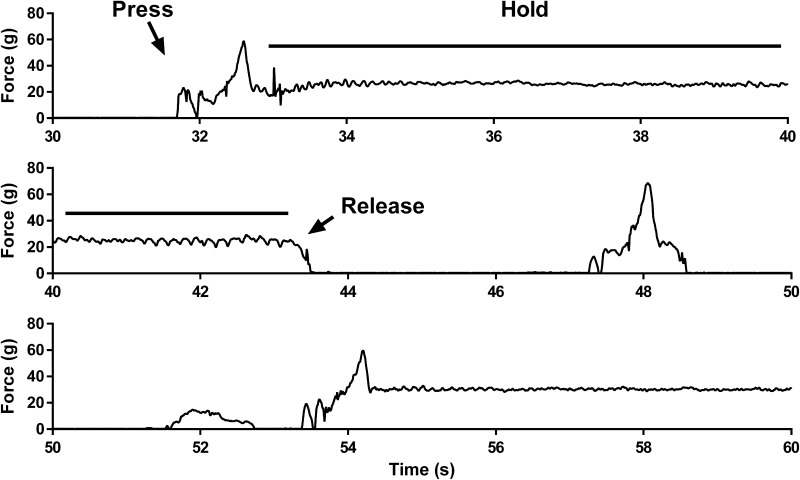 Forelimb Resistance Exercise Protects Against Neuromuscular Junction Denervation in the SOD1-G93A Rat Model of ALS.