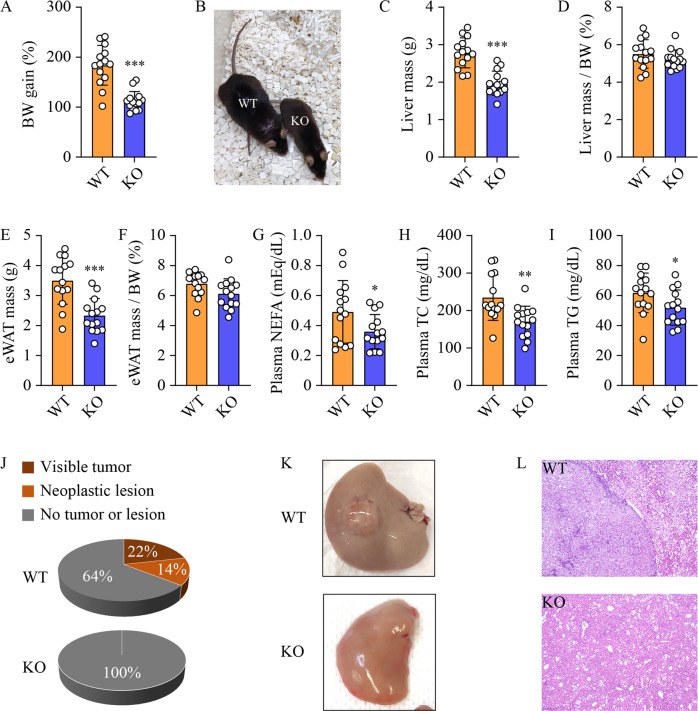 Ablation of sphingosine kinase 2 suppresses fatty liver-associated hepatocellular carcinoma via downregulation of ceramide transfer protein.