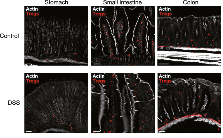 Localization and movement of Tregs in gastrointestinal tract: a systematic review.