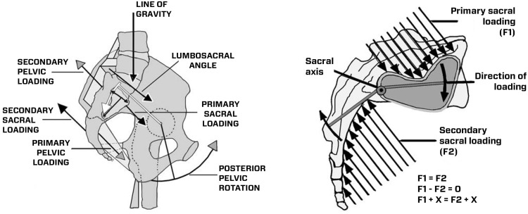 Minimally Invasive Inferior Intra-Articular Sacroiliac Joint Fusion: Successful Application of Osseous Stabilization Using Allograft Bone.