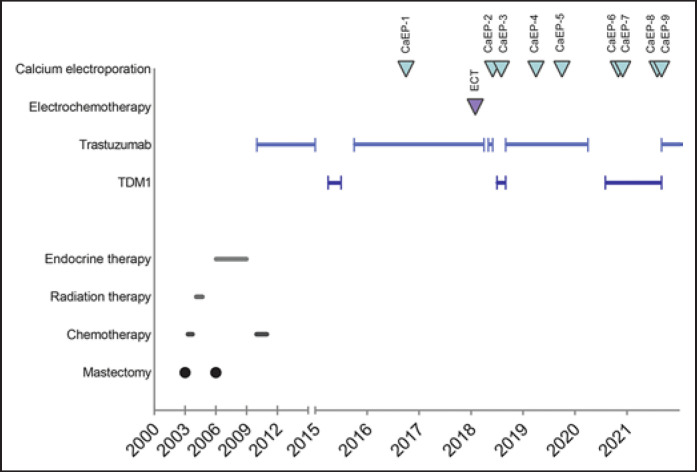 Calcium Electroporation for Management of Cutaneous Metastases in HER2-Positive Breast Cancer: A Case Report.