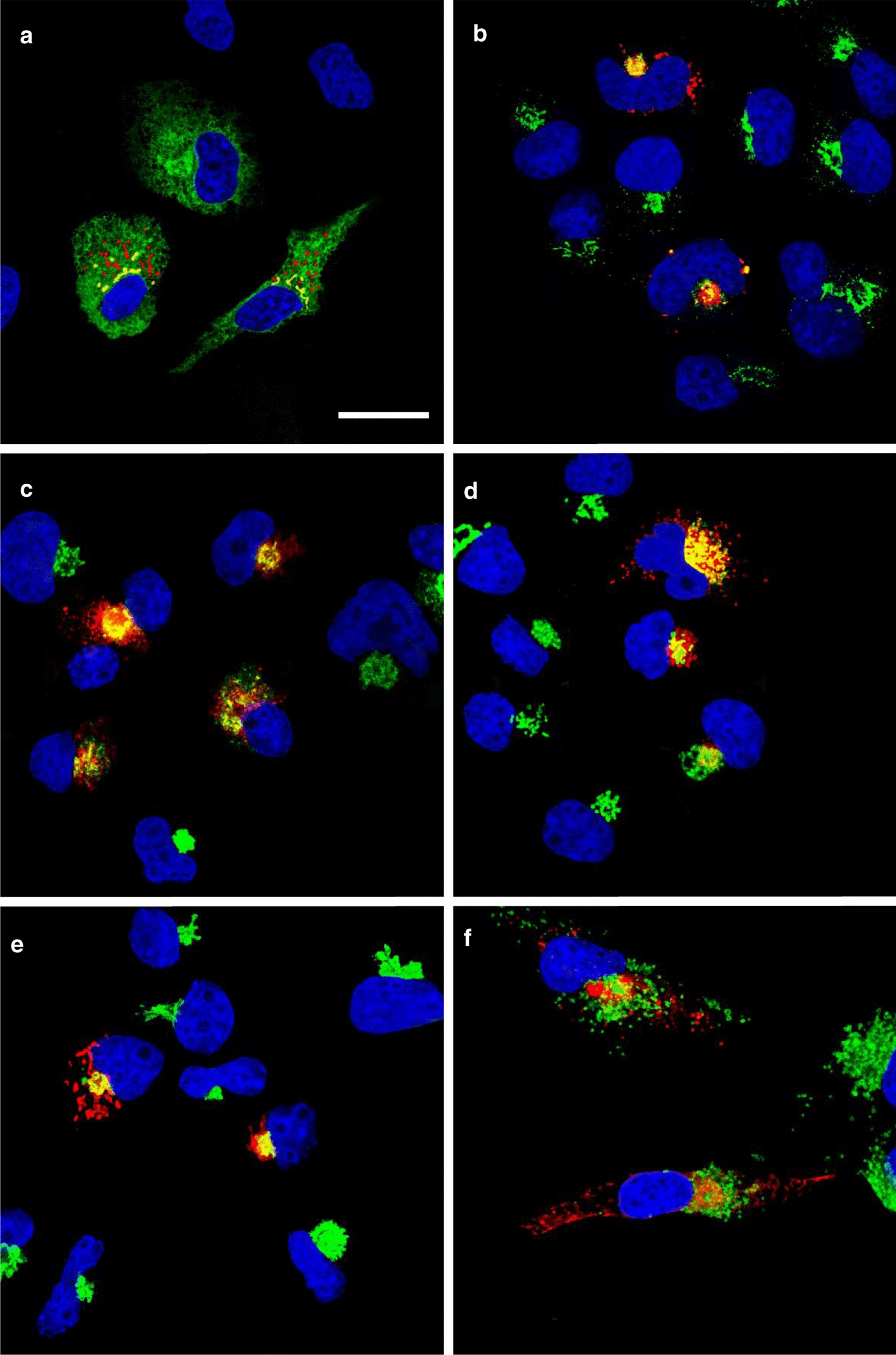 The envelope proteins from SARS-CoV-2 and SARS-CoV potently reduce the infectivity of human immunodeficiency virus type 1 (HIV-1).