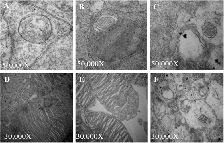 Changes of Beclin-1 and ULK1 in retina of mice model in oxygen-inducedretinopathy