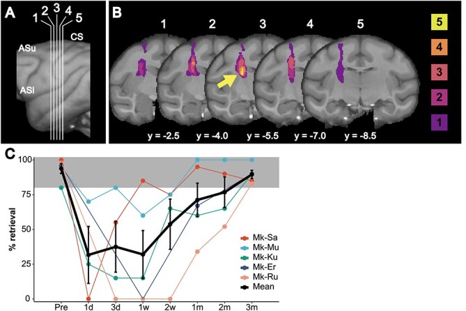 Structural plasticity of motor cortices assessed by voxel-based morphometry and immunohistochemical analysis following internal capsular infarcts in macaque monkeys.