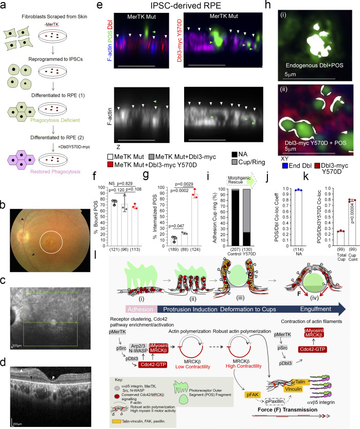 Spatiotemporal control of actomyosin contractility by MRCKβ signaling drives phagocytosis.