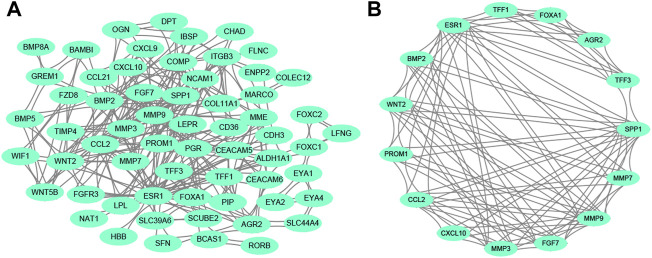 Anterior Gradient 2 is a Significant Prognostic Biomarker in Bone Metastasis of Breast Cancer.