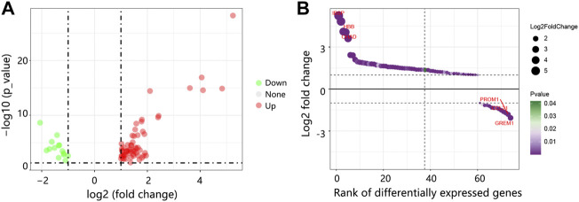 Anterior Gradient 2 is a Significant Prognostic Biomarker in Bone Metastasis of Breast Cancer.
