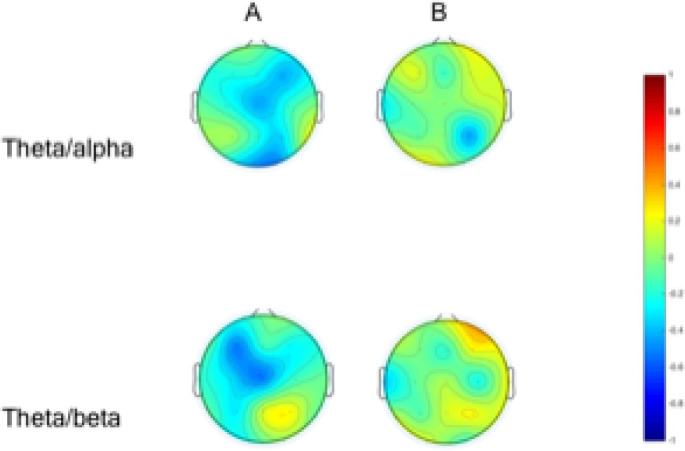 Brain Functional Correlates of Intelligence Score in ADHD Based on EEG.