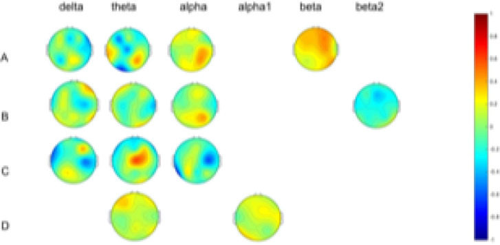 Brain Functional Correlates of Intelligence Score in ADHD Based on EEG.