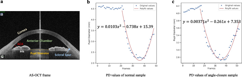 Dynamic analysis of iris changes and a deep learning system for automated angle-closure classification based on AS-OCT videos.