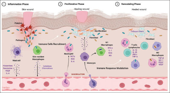 Local anti-inflammatory effect and immunomodulatory activity of chitosan-based dressing in skin wound healing: A systematic review.